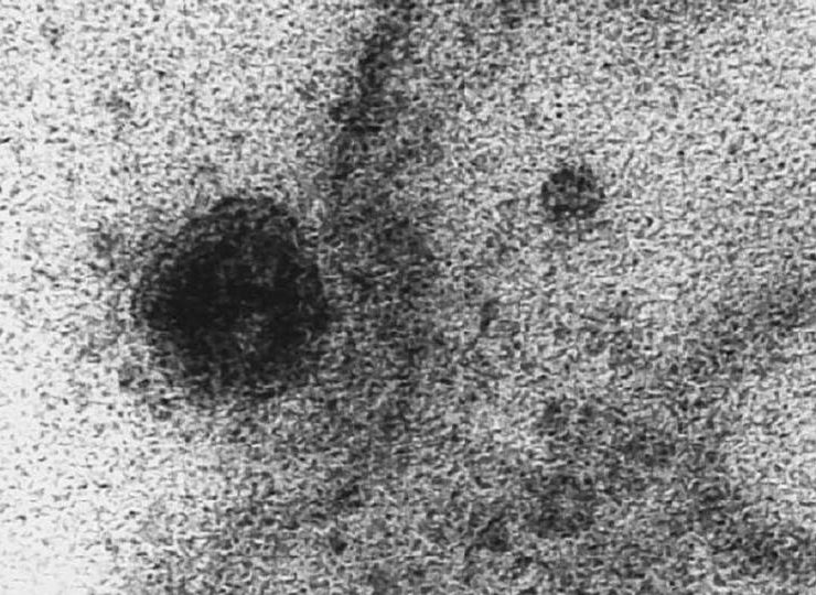 أول مرة بالفيديو المجهري شاهد رصد لفايروس كورونا وهو يمسك بالخلية