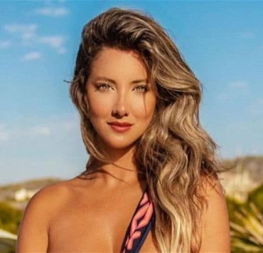 بتر ساق ملكة جمال كولومبيا عقب اكتشاف خلل في الشرايين
