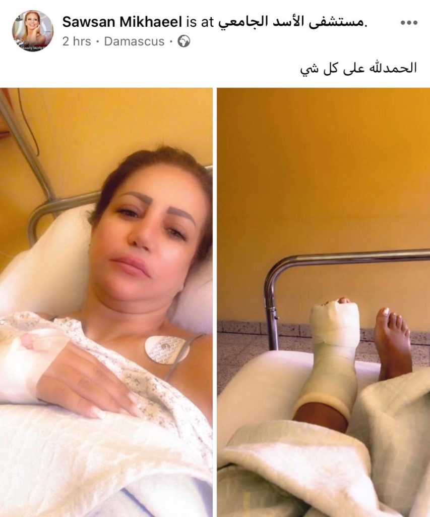 سوسن ميخائيل تدخل المستشفى إثر حادث سقوط