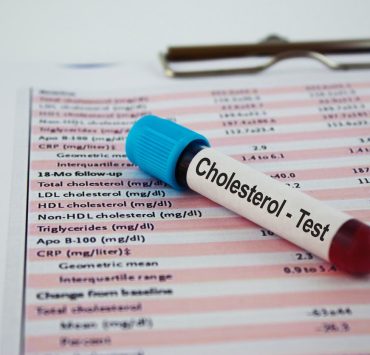 أمل واعد في محاربة الوباء من دواء للكولسترول