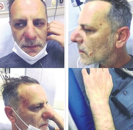 القضاء التركي يأمر بسجن الممثل #أوزان_جوفين 13 عاماً بسبب ضربه حبيبته