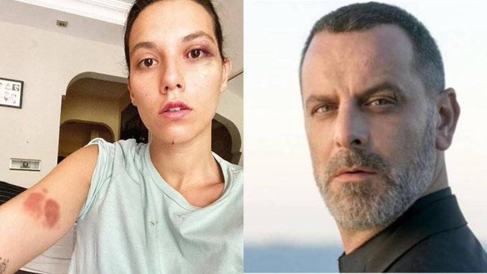 القضاء التركي يأمر بسجن الممثل #أوزان_جوفين 13 عاماً بسبب ضربه حبيبته