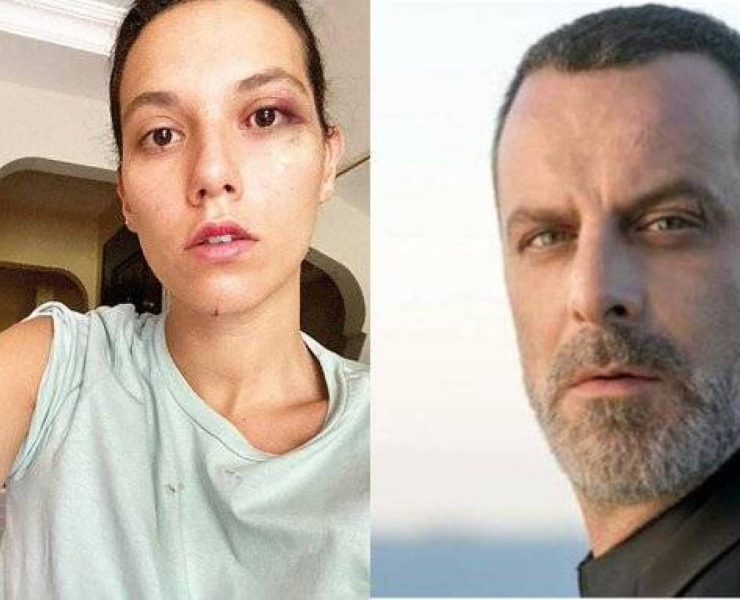 القضاء التركي يأمر بسجن الممثل #أوزان_جوفين 13 عاماً بسبب ضربه حبيبته