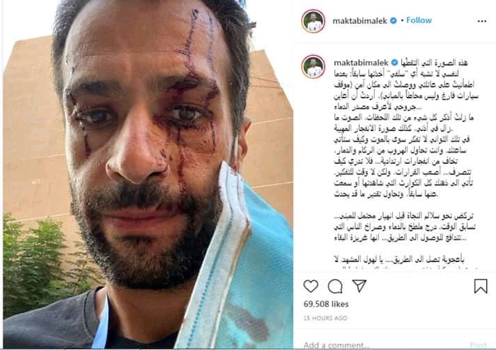 مالك مكتبي يفاجئ جمهوره بصورة تظهر إصابته بالانفجار
