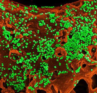 لماذا ينتشر فيروس كورونا بهذه السرعة الرهيبة؟