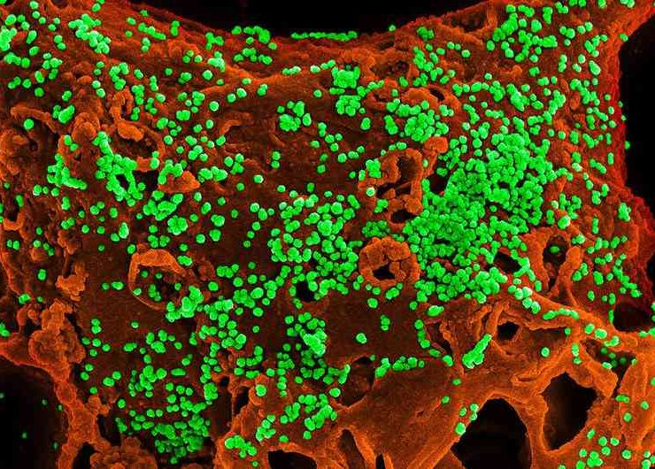 لماذا ينتشر فيروس كورونا بهذه السرعة الرهيبة؟