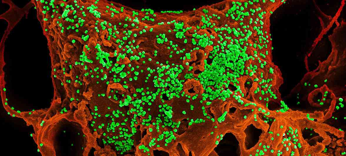 لماذا ينتشر فيروس كورونا بهذه السرعة الرهيبة؟