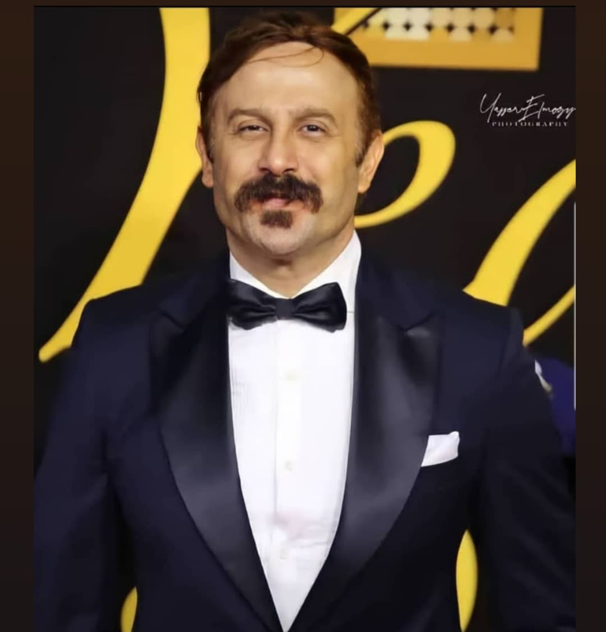 قصي خولي يرد على اتهام الجمهور له بخضوعه للتجميل