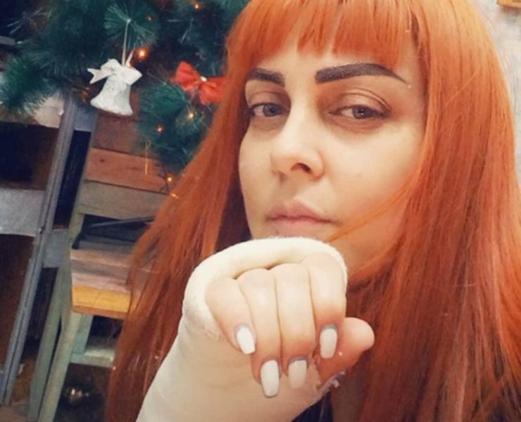 رنا ريشة تتعرض لحادث وتصّر على استمرارها بالعمل