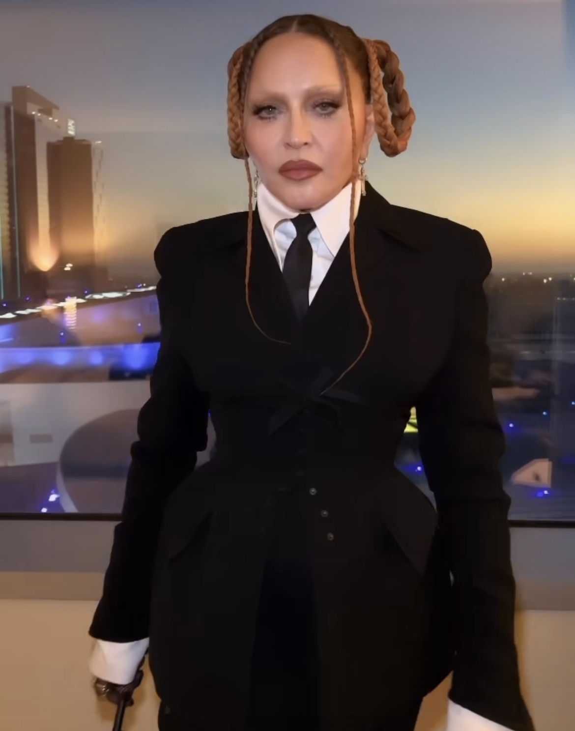 في عيد الحب.. مادونا تدعو الجميع للتبرع