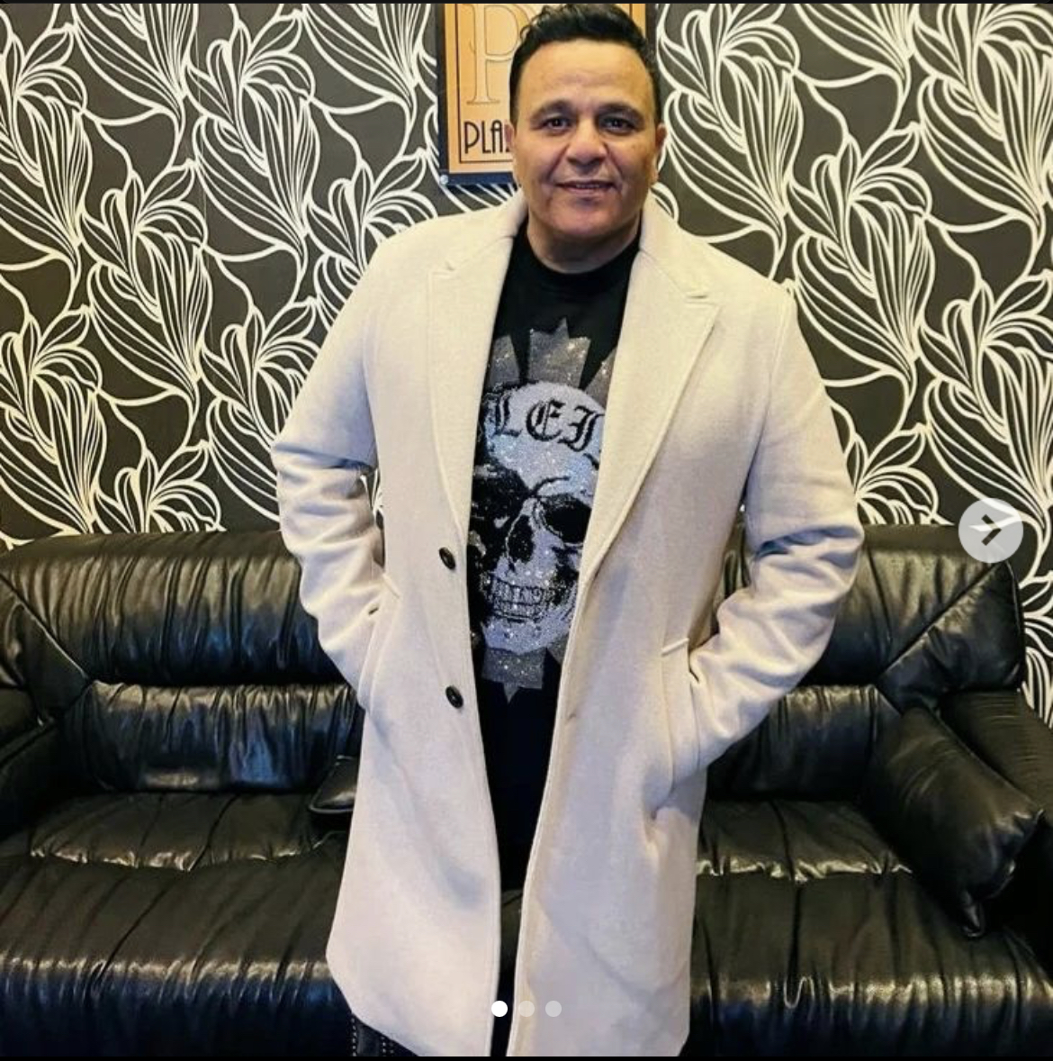 هل خضع محمد فؤاد لعملية تكميم معدة؟
