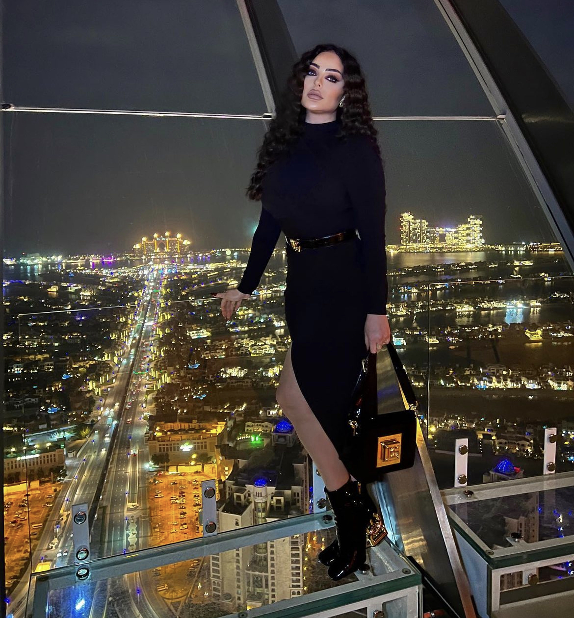 زين كرزون تخضع لعملية "قص معدة"