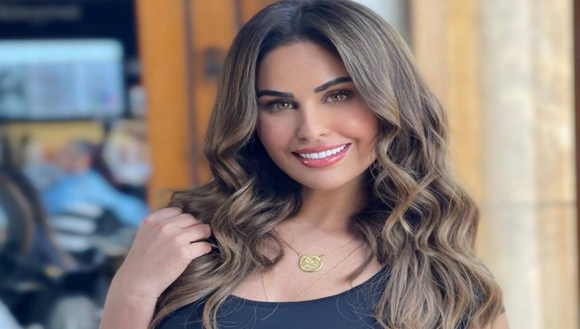 بعد تعرضها لحادث سير خطير .. مي سليم تطمئن جمهورها-صورة