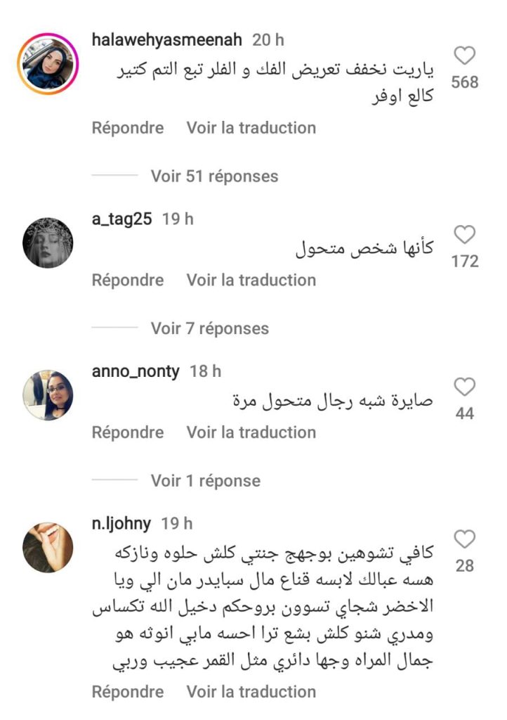 عمليات التجميل تجعل نادين نجيم عرضة لـ"التنمر"-صورة