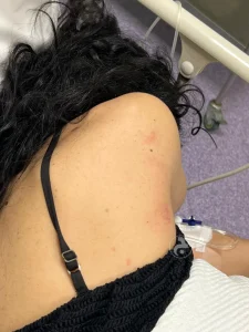 الكدمات واضحة.. نادين الراسي تتعرض للضرب.. فمن الفاعل؟