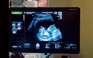 بسبب باريس.. مالوما يعلن دخوله مرحلة جديدة في حياته