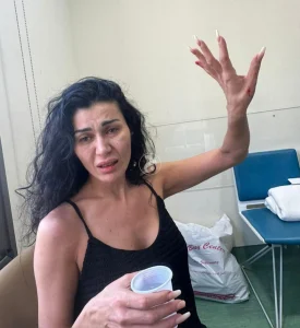 الكدمات واضحة.. نادين الراسي تتعرض للضرب.. فمن الفاعل؟