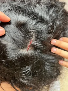 الكدمات واضحة.. نادين الراسي تتعرض للضرب.. فمن الفاعل؟