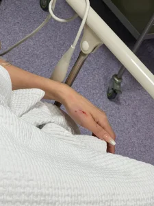 الكدمات واضحة.. نادين الراسي تتعرض للضرب.. فمن الفاعل؟